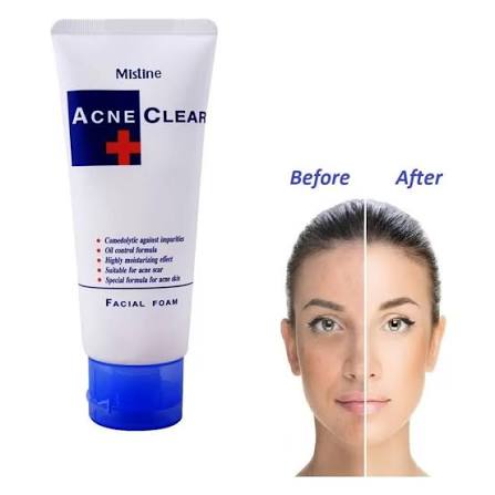 Mistine Acne clear face wash 100ml